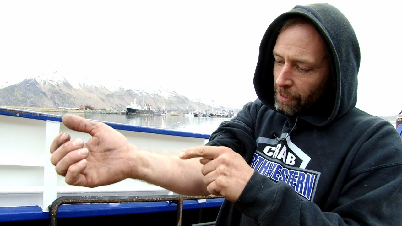 Edgar Hansen Slices Open His Arm at Sea