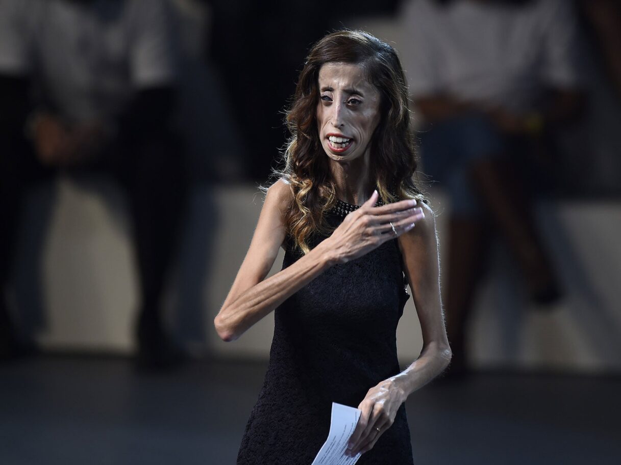 Lizzie Velasquez: How the activist named 'world's ugliest woman' tackled trolls by launching a global campaign | The Independent | The Independent