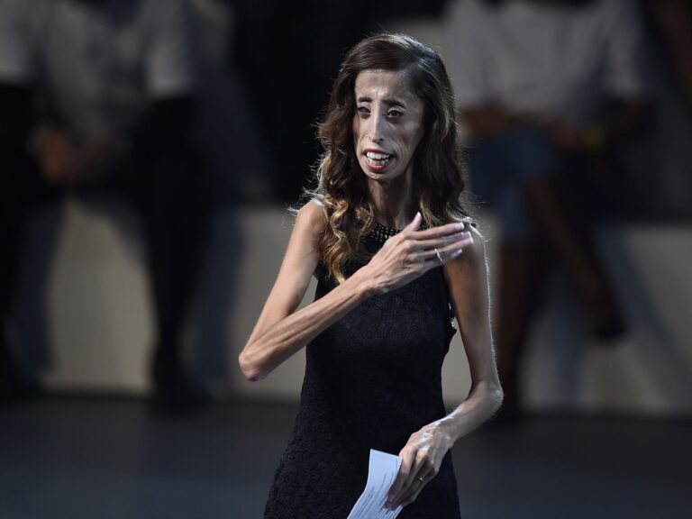 Lizzie Velasquez: How the activist named 'world's ugliest woman' tackled trolls by launching a global campaign | The Independent | The Independent